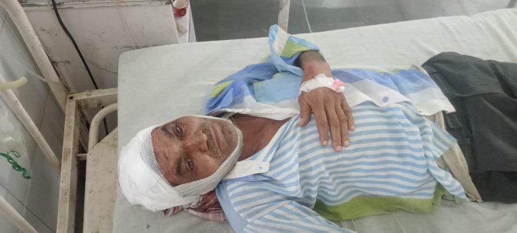 पिकअप गाड़ी में सवार होकर आए तीन बदमाशों ने होटल को मारी टक्कर, सोए हुए मालिक के सर में लगी, अस्पताल में भर्ती सिगरेट को लेकर हुआ झगड़ा