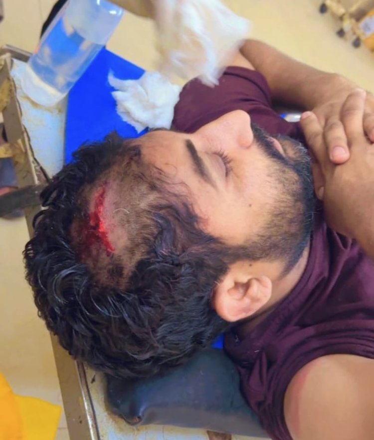 दुकानदार सहित दो लोगों पर एकराय होकर कुल्हाड़ी व सरियों से जानलेवा हमला करने व गल्ले से रूपये लूट कर ले जाने का आरोप, 11 लोगों के खिलाफ मामला दर्ज 
