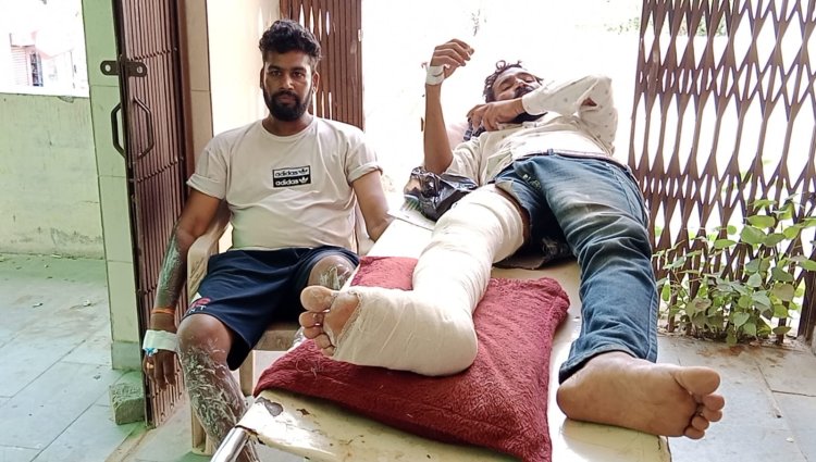 दो सगे भाइयों को पेट्रोल डालकर जलाने का प्रयास, इलाके में फैली सनसनी, चार नामजद सहित 5-6 अन्य के खिलाफ हुआ मामला दर्ज